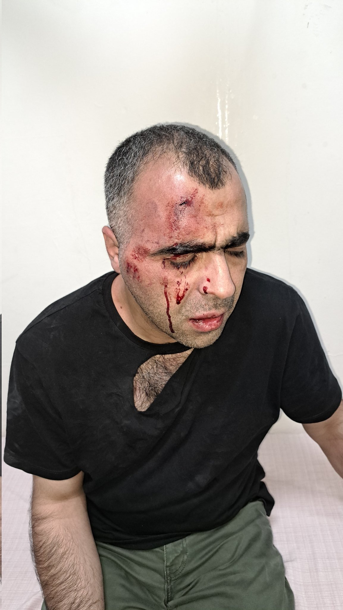 Gazeteci Sinan Aygül’ü Darp Edenlere Flaş Gelişme