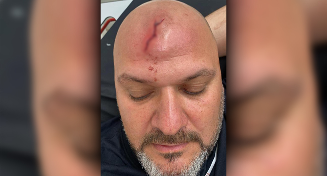 70 bin liralık kira artışını kabul etmeyen kiracısını öldüresiye dövdüler