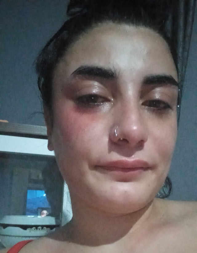 Hamile kadını sokak ortasında darp eden adam kadının düşük yapmasına neden oldu