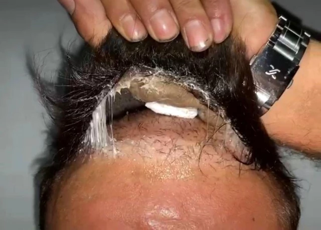 Hareketlerinden şüphelenilen şahısın peruğundan uyuşturucu çıktı