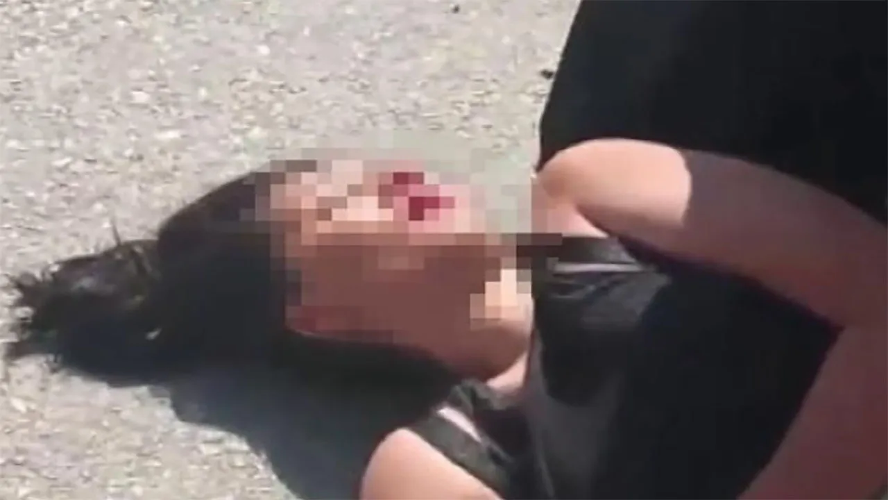 Boşanma aşamasındaki eşini sokak ortasında bayıltana kadar dövdü