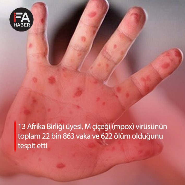 Maymun çiçeği virüsü hızla artarken vaka ve ölüm sayısı belli oldu